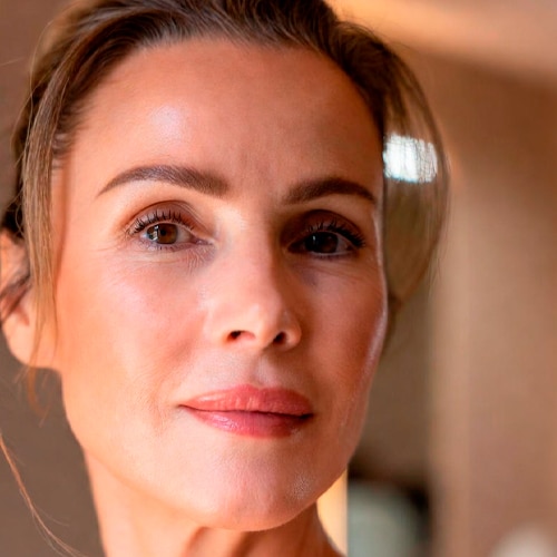 Los rellenos faciales se aplican con inyección de ácido hialurónico, un compuesto presente en el organismo que aporta volumen e hidratación. El tratamiento lo realiza un médico especialista, con resultados seguros y naturales. | Adelgar, tu clínica de adelgazamiento, medicina y cirugía estética en Madrid.